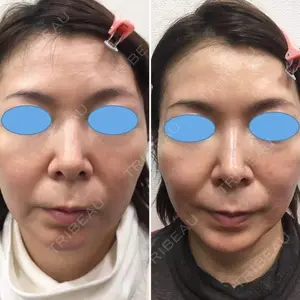 しのぶ皮膚科 蘇原しのぶ医師の症例