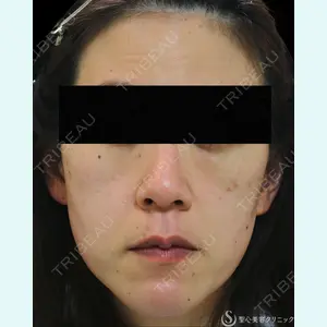 聖心美容クリニック 熱海院 小林 美幸（皮膚科）医師の症例