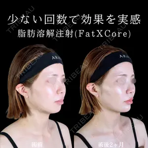 アリエル美容クリニック 郡山院 安齋 誠基医師の症例