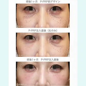 聖心美容クリニック 札幌院 前多 一彦医師の症例