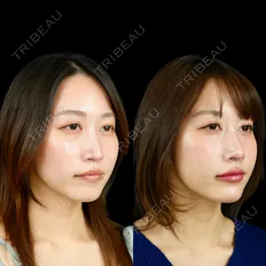 ルラ美容クリニック 池袋院 小海 元医師の症例