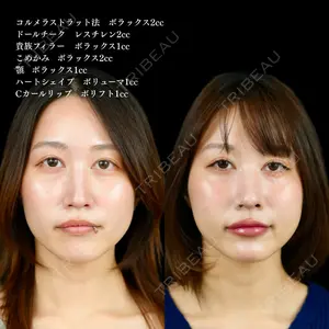 ルラ美容クリニック 池袋院 小海 元医師の症例