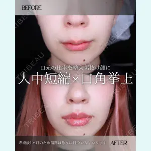 小倉美容外科/美容皮膚科 ビラビューティークリニック 大村 亞蘭医師の症例