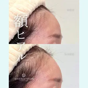 Moon Beauty Clinic 渡邉 正士医師の症例