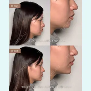 Moon Beauty Clinic 渡邉 正士医師の症例