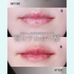 小倉美容外科/美容皮膚科 ビラビューティークリニックの症例