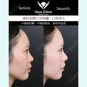 Otus Clinic 【オータスクリニック】 中 徳太郎医師の症例