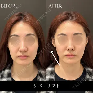 RIVER CLINIC（リバークリニック）の症例