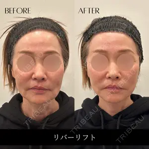 RIVER CLINIC（リバークリニック）の症例