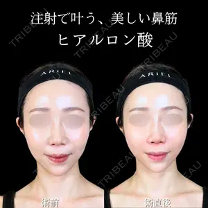 アリエル美容クリニック 大宮院 鈴木　桂介医師の症例