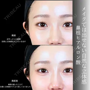 アリエル美容クリニック 大宮院 鈴木　桂介医師の症例