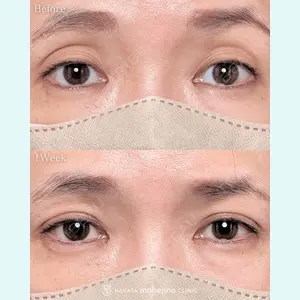 博多もへじのクリニック 村田 将光医師の症例