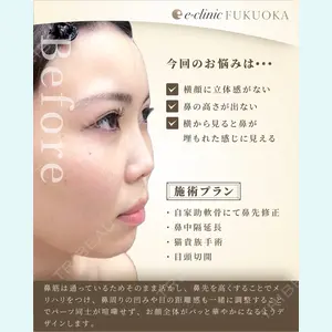 eクリニック 大阪院 長瀬 大蔵医師の症例