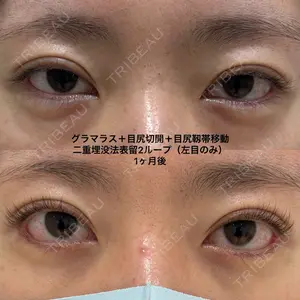 エターナル美容クリニック 久門田 詳医師の症例