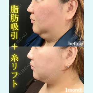 THE FIRST CLINIC 町田院 木暮 啓一郎医師の症例