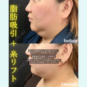 THE FIRST CLINIC 町田院 木暮 啓一郎医師の症例