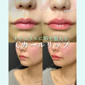 ルラ美容クリニック 岐阜院 馬場 愛理医師の症例