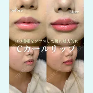 ルラ美容クリニック 岐阜院 馬場 愛理医師の症例