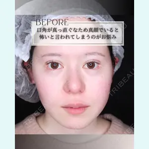 小倉美容外科/美容皮膚科 ビラビューティークリニック 大村 亞蘭医師の症例