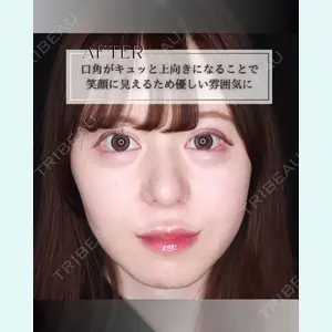 小倉美容外科/美容皮膚科 ビラビューティークリニック 大村 亞蘭医師の症例