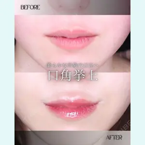 小倉美容外科/美容皮膚科 ビラビューティークリニック 大村 亞蘭医師の症例