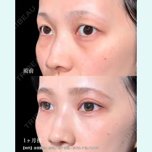 東京シンデレラ美容外科 大宮院 竹田 昌平医師の症例