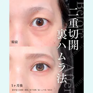 東京シンデレラ美容外科 大宮院 竹田 昌平医師の症例