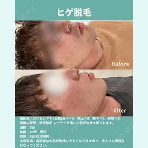 ヴァンヴェールクリニック 高槻院 李 愚姫医師の症例