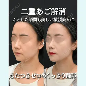 湘南美容クリニック 名古屋駅本院 高川 裕也医師の症例