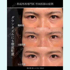 東京シンデレラ美容外科 大宮院 竹田 昌平医師の症例