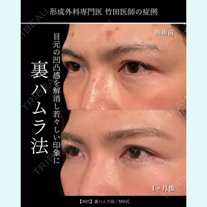 東京シンデレラ美容外科 大宮院 竹田 昌平医師の症例