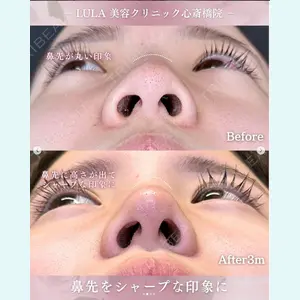ルラ美容クリニック 大阪心斎橋院の症例