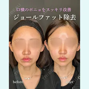 ルラ美容クリニック 岐阜院 馬場 愛理医師の症例