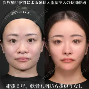 Zetith Beauty Clinic 銀座院 鉄 鑠医師の症例