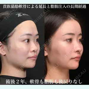 Zetith Beauty Clinic 銀座院 鉄 鑠医師の症例
