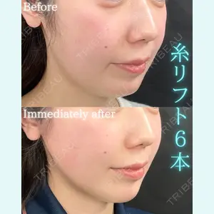 THE FIRST CLINIC 町田院 木暮 啓一郎医師の症例