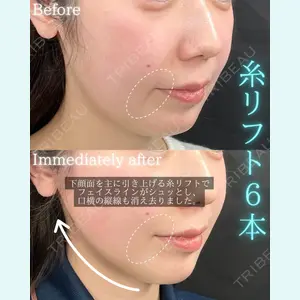 THE FIRST CLINIC 町田院 木暮 啓一郎医師の症例