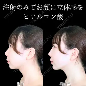 アリエル美容クリニック 大宮院 鈴木　桂介医師の症例