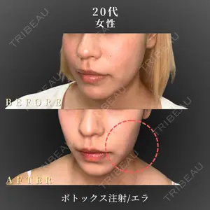 BiBiクリニック 山本 幸一郎医師の症例