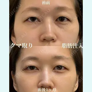 お茶の水美容形成クリニック 吉井 健吾医師の症例