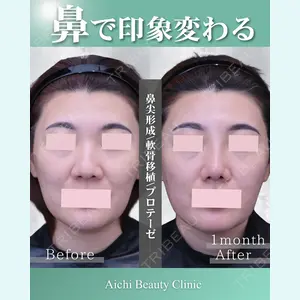 症例