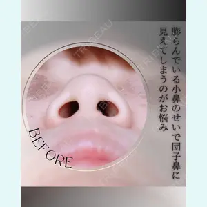 小倉美容外科/美容皮膚科 ビラビューティークリニック 大村 亞蘭医師の症例