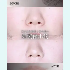 小倉美容外科/美容皮膚科 ビラビューティークリニック 大村 亞蘭医師の症例