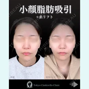 東京シンデレラ美容外科 池袋院 石井 達也医師の症例