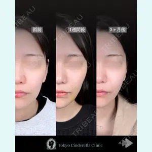 東京シンデレラ美容外科 池袋院 石井 達也医師の症例