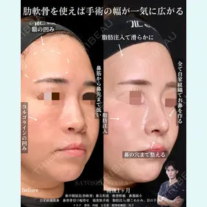 Zetith Beauty Clinic 銀座院 小川 悟史医師の症例