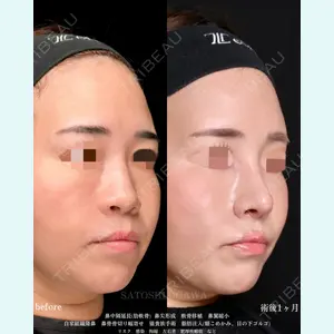 Zetith Beauty Clinic 銀座院 小川 悟史医師の症例