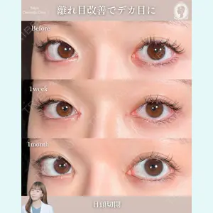 東京シンデレラ美容外科 新宿院 宮﨑友伽医師の症例