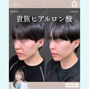 東京シンデレラ美容外科 新宿院 宮﨑友伽医師の症例