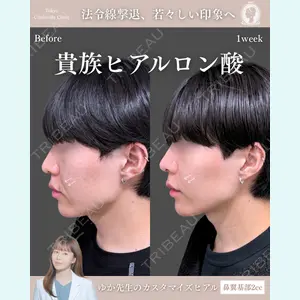 東京シンデレラ美容外科 新宿院 宮﨑友伽医師の症例